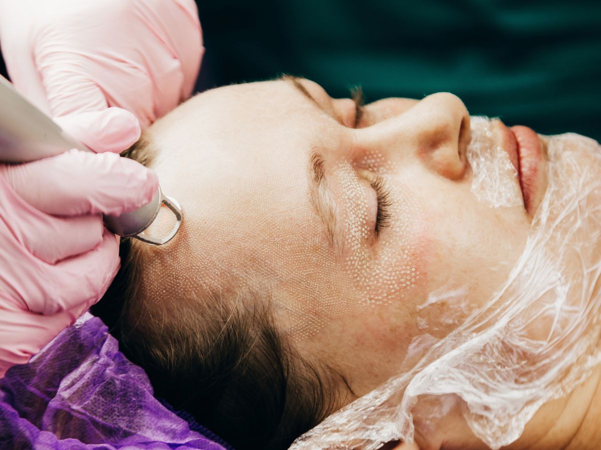 laseroterapia w gabinecie Dermestic