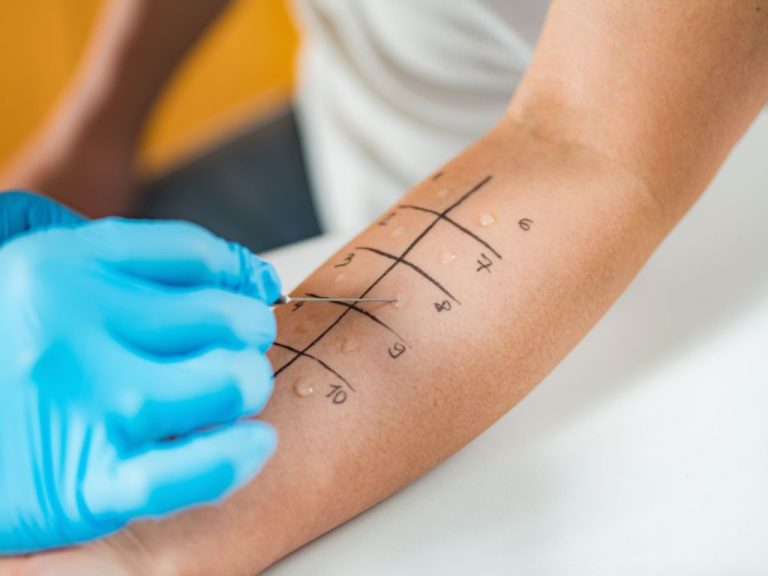 Kiedy udać się do dermatologa?