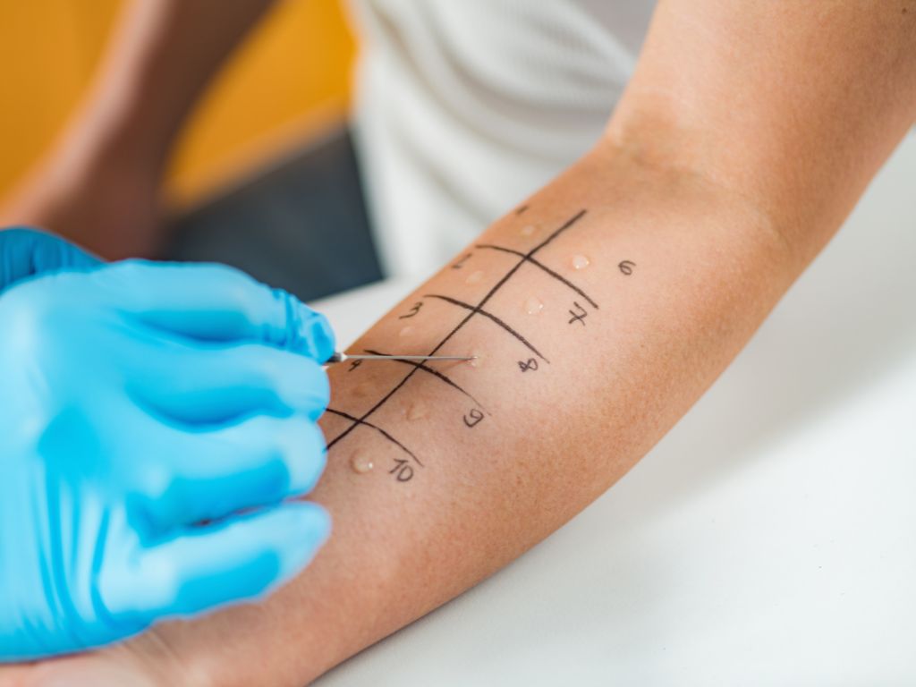 Kiedy udać się do dermatologa