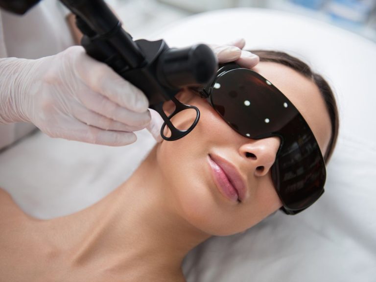 Retinoidy doustne a laseroterapia i inne zabiegi medycyny estetycznej