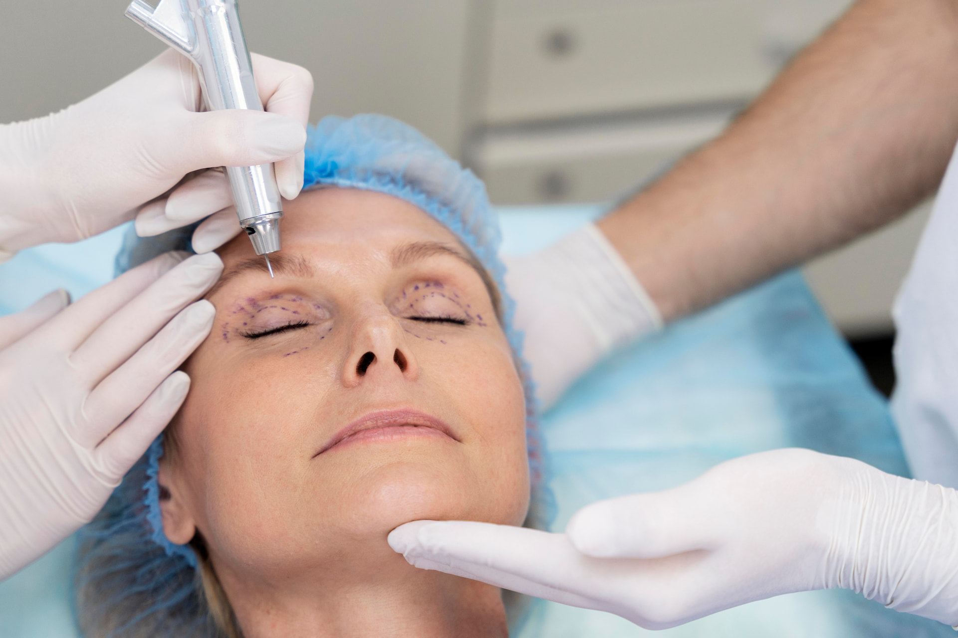 Blefaroplastyka powiek